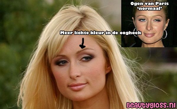 dik boven ooglid