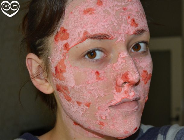 acne masker