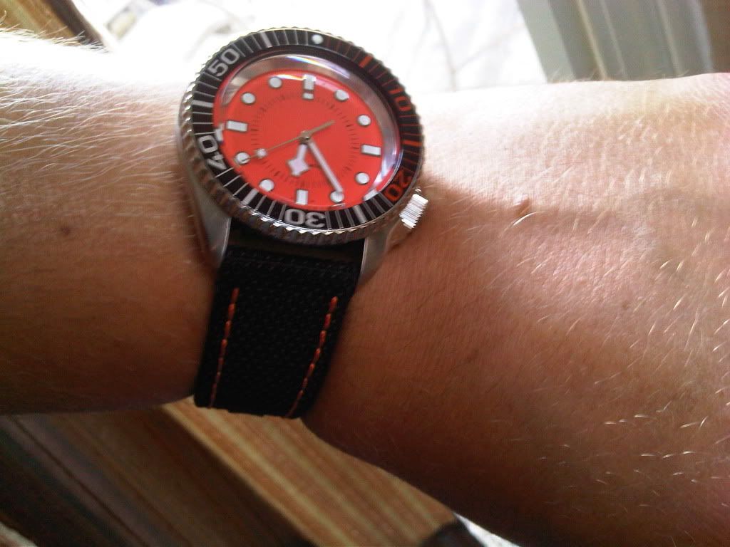 At What Location on Your Wrist Do You Wear Your Watch (Poll)?